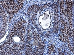 Invitrogen TBX5 Polyclonal Antibody 100 &mu;L; Unconjugated:Antibodies,