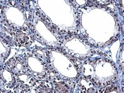 Invitrogen TBX5 Polyclonal Antibody 100 &mu;L; Unconjugated:Antibodies,