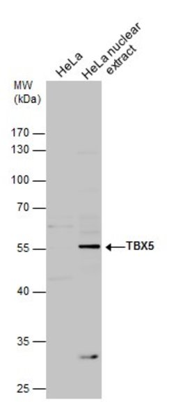 Invitrogen TBX5 Polyclonal Antibody 100 &mu;L; Unconjugated:Antibodies,