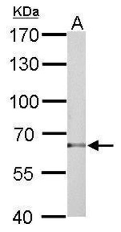 Invitrogen TBX5 Polyclonal Antibody 100 &mu;L; Unconjugated:Antibodies,