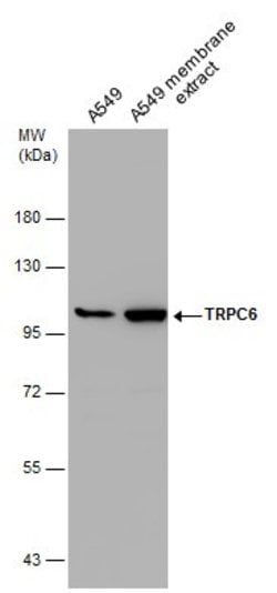 Invitrogen TRPC6 Polyclonal Antibody 100 μL; Unconjugated:Antibodies,