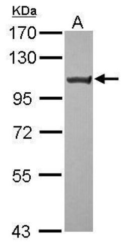Invitrogen TRPC6 Polyclonal Antibody 100 μL; Unconjugated:Antibodies,