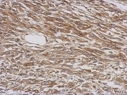 Invitrogen WARS Polyclonal Antibody 100 &mu;L; Unconjugated:Antibodies,