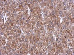 Invitrogen WARS Polyclonal Antibody 100 &mu;L; Unconjugated:Antibodies,