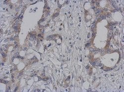 Invitrogen DAP3 Polyclonal Antibody 100 &mu;L; Unconjugated:Antibodies,