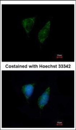 Invitrogen DAP3 Polyclonal Antibody 100 &mu;L | Buy Online | Invitrogen&trade; | Fisher Scientific