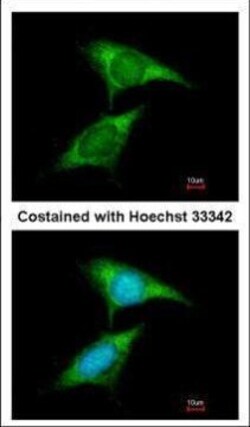 Invitrogen FXR1 Polyclonal Antibody 100 μL; Unconjugated:Antibodies,