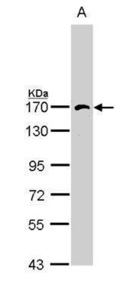 Invitrogen AP3B1 Polyclonal Antibody 100 &mu;L; Unconjugated:Antibodies,