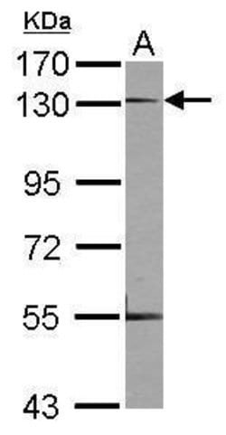Invitrogen Neuropilin 1 Polyclonal Antibody 100 &mu;L; Unconjugated:Antibodies,
