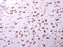 Invitrogen AIP Polyclonal Antibody 100 &mu;L | Buy Online | Invitrogen&trade; | Fisher Scientific