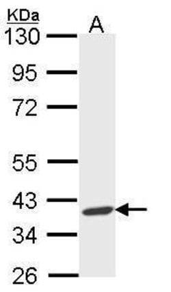 Invitrogen AIP Polyclonal Antibody 100 &mu;L | Buy Online | Invitrogen&trade; | Fisher Scientific