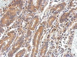 Invitrogen PAPSS2 Polyclonal Antibody 100 &mu;L; Unconjugated:Antibodies,