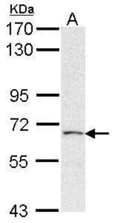 Invitrogen PAPSS2 Polyclonal Antibody 100 &mu;L; Unconjugated:Antibodies,
