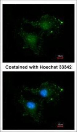 Invitrogen Bcl-B Polyclonal Antibody 100 &mu;L; Unconjugated:Antibodies,