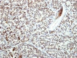 Invitrogen Bcl-B Polyclonal Antibody 100 &mu;L; Unconjugated:Antibodies,