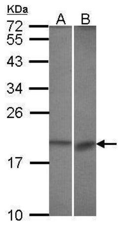 Invitrogen Bcl-B Polyclonal Antibody 100 &mu;L; Unconjugated:Antibodies,