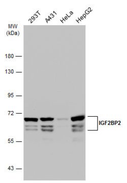 Invitrogen IGF2BP2 Polyclonal Antibody 100 &mu;L | Buy Online | Invitrogen&trade; | Fisher Scientific