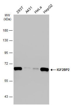 Invitrogen IGF2BP2 Polyclonal Antibody 100 &mu;L; Unconjugated:Antibodies,