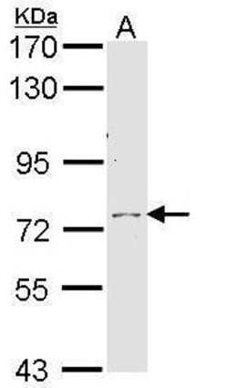 Invitrogen Calpain 10 Polyclonal Antibody 100 &mu;L; Unconjugated:Antibodies,