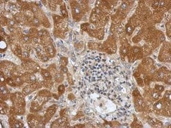 Invitrogen Calpain 10 Polyclonal Antibody 100 &mu;L; Unconjugated:Antibodies,