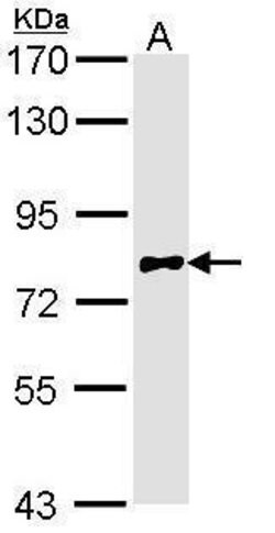 Invitrogen Calpain 10 Polyclonal Antibody 100 &mu;L; Unconjugated:Antibodies,