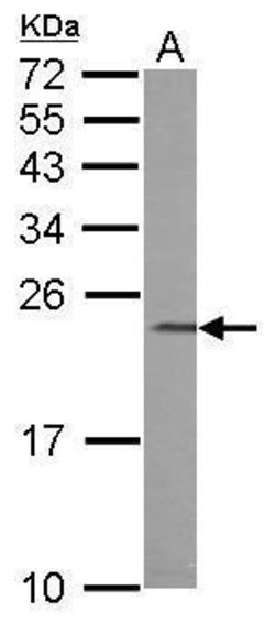 Invitrogen CHP1 Polyclonal Antibody 100 &mu;L; Unconjugated:Antibodies,