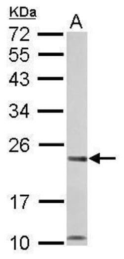 Invitrogen CHP1 Polyclonal Antibody 100 &mu;L; Unconjugated:Antibodies,