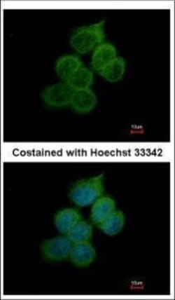 Invitrogen BACE2 Polyclonal Antibody 100 &mu;L; Unconjugated:Antibodies,
