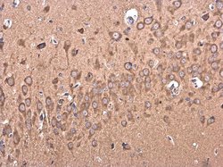 Invitrogen BACE2 Polyclonal Antibody 100 &mu;L; Unconjugated:Antibodies,