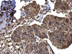 Invitrogen BACE2 Polyclonal Antibody 100 &mu;L; Unconjugated:Antibodies,