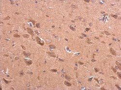 Invitrogen BACE2 Polyclonal Antibody 100 &mu;L; Unconjugated:Antibodies,