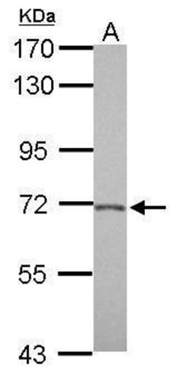 Invitrogen BACE2 Polyclonal Antibody 100 &mu;L; Unconjugated:Antibodies,