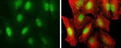 Invitrogen UHRF1 Polyclonal Antibody 100 &mu;L; Unconjugated:Antibodies,