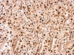 Invitrogen UHRF1 Polyclonal Antibody 100 &mu;L; Unconjugated:Antibodies,