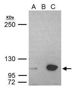 Invitrogen UHRF1 Polyclonal Antibody 100 &mu;L; Unconjugated:Antibodies,