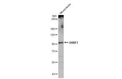 Invitrogen UHRF1 Polyclonal Antibody 100 &mu;L; Unconjugated:Antibodies,