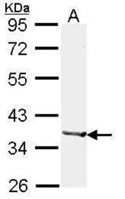Invitrogen Alcohol Dehydrogenase 1B Polyclonal Antibody 100 μL; Unconjugated:Antibodies,