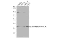 Invitrogen Alcohol Dehydrogenase 1B Polyclonal Antibody 100 μL; Unconjugated:Antibodies,