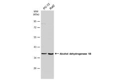Invitrogen Alcohol Dehydrogenase 1B Polyclonal Antibody 100 μL; Unconjugated:Antibodies,