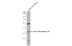 Invitrogen Alcohol Dehydrogenase 1B Polyclonal Antibody 100 μL; Unconjugated:Antibodies,