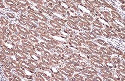 Invitrogen V-ATPase E1 Polyclonal Antibody 100 μL; Unconjugated:Antibodies,