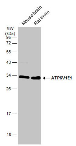 Invitrogen V-ATPase E1 Polyclonal Antibody 100 μL; Unconjugated:Antibodies,