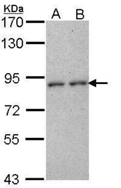 CD6 Polyclonal Antibody, Invitrogen 100 &mu;L; Unconjugated:Antibodies,