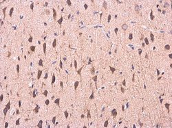 Invitrogen COMT Polyclonal Antibody 100 &mu;L | Buy Online | Invitrogen&trade; | Fisher Scientific
