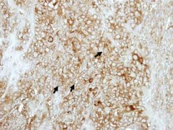 Invitrogen COMT Polyclonal Antibody 100 &mu;L | Buy Online | Invitrogen&trade; | Fisher Scientific