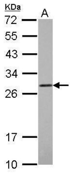 Invitrogen COMT Polyclonal Antibody 100 &mu;L | Buy Online | Invitrogen&trade; | Fisher Scientific