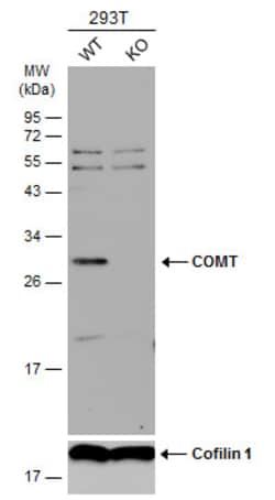 Invitrogen COMT Polyclonal Antibody 100 &mu;L | Buy Online | Invitrogen&trade; | Fisher Scientific