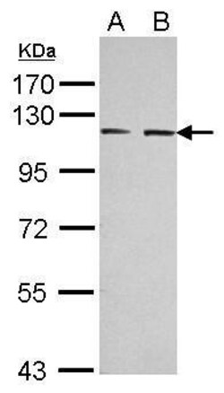 Invitrogen EphA3 Polyclonal Antibody 100 &mu;L | Buy Online | Invitrogen&trade; | Fisher Scientific