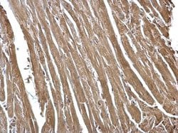 Invitrogen FHL2 Polyclonal Antibody 100 &mu;L; Unconjugated:Antibodies,