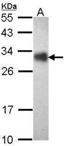 Invitrogen FHL2 Polyclonal Antibody 100 &mu;L; Unconjugated:Antibodies,